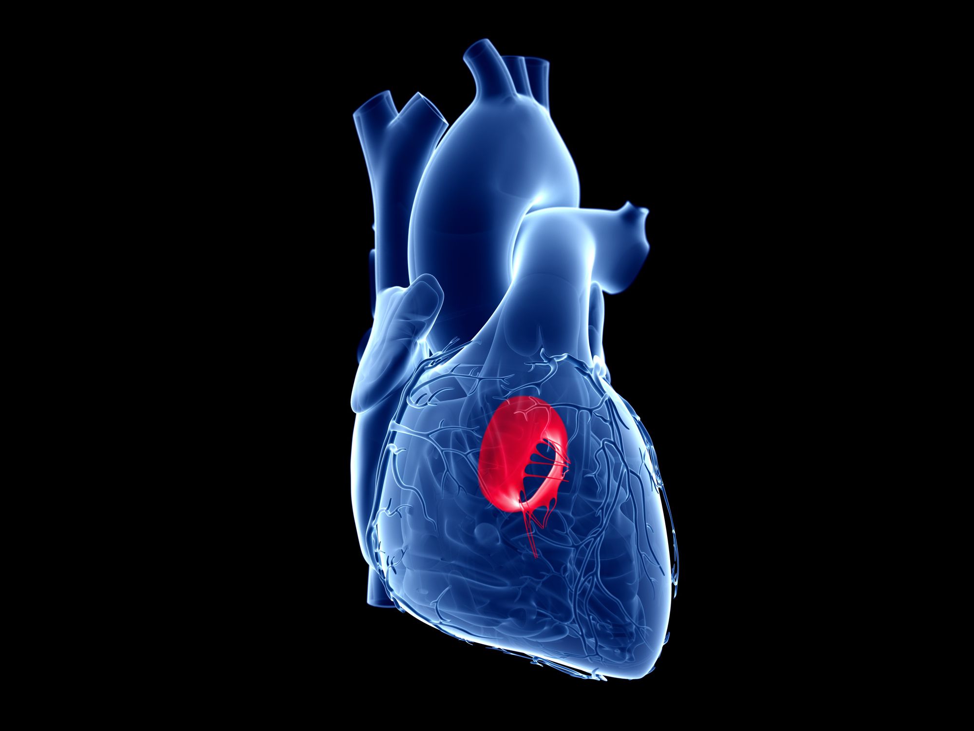 Heart Valve Surgery Doctor in Thane