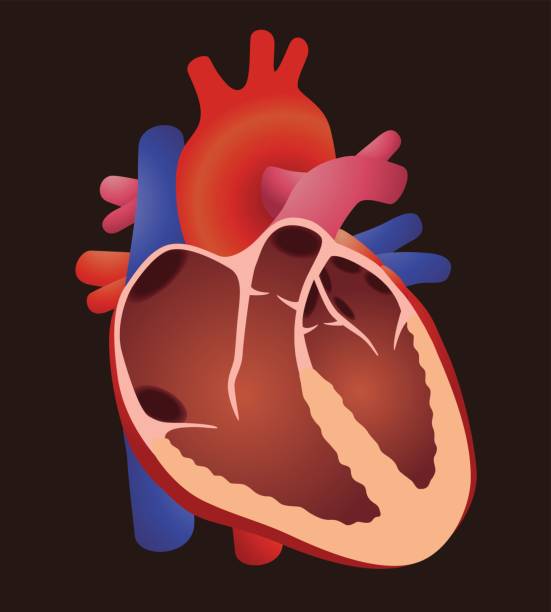 heart valve disease causes