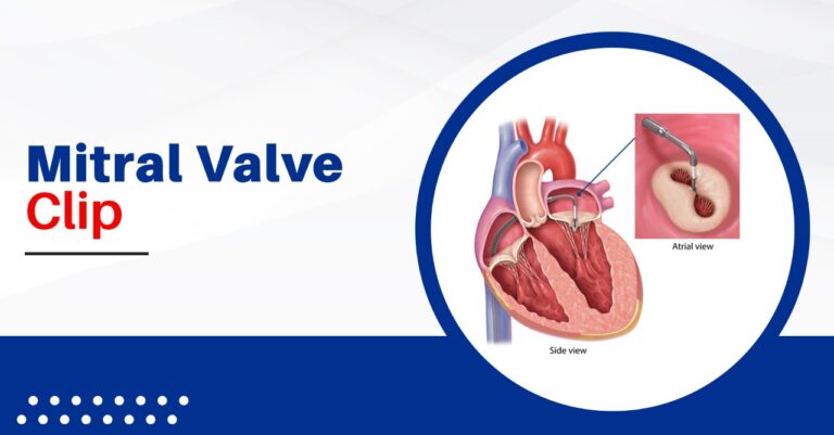 Mitral Valve Clip | Procedure and Recovery | Dr Mayur Jain